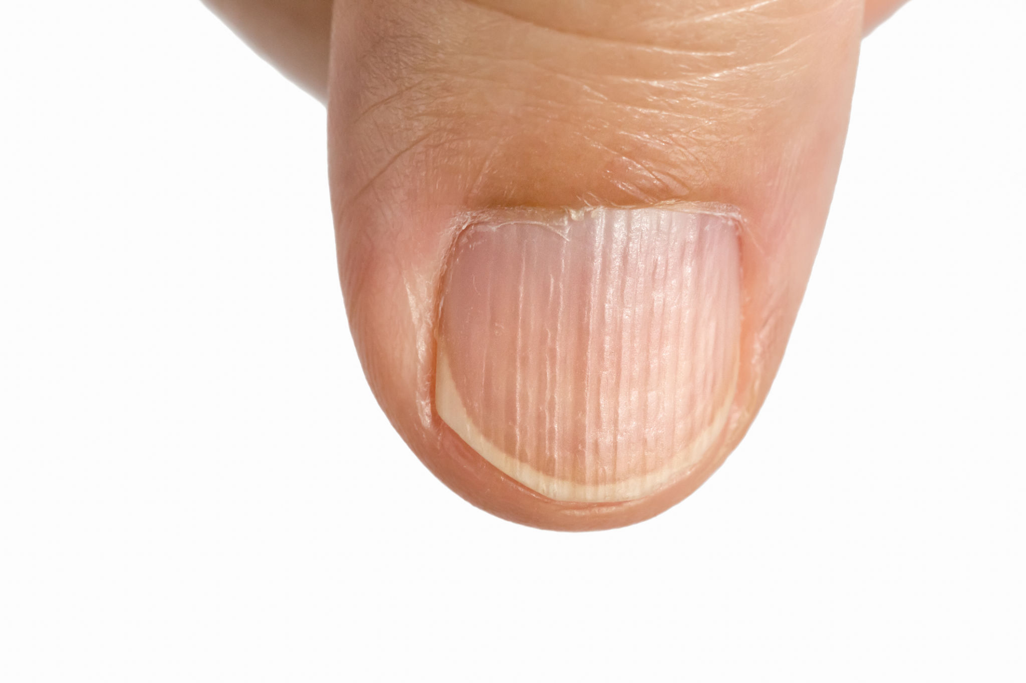 What Your Nails Are Trying to Tell You